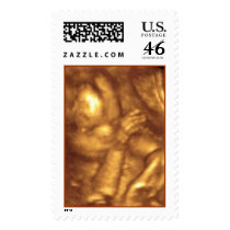 4D Ultrasound Postage Stamp