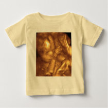 4D Ultrasound t-shirts