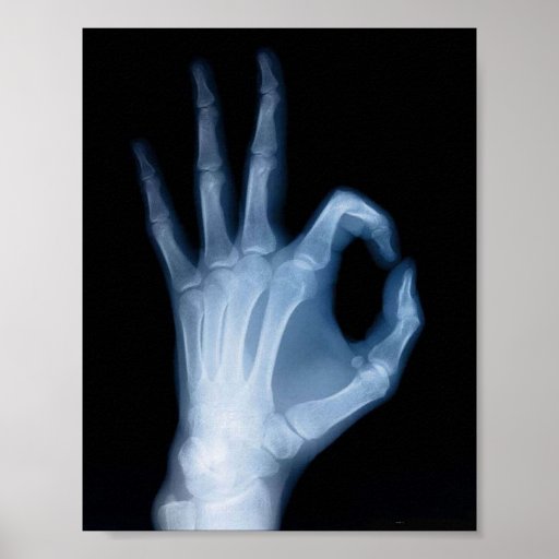 X Ray Poster Design | a ok x ray poster zazzle X Ray Poster Design | a ok x ray poster zazzle