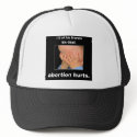 abortion hurts hats by TheCatholicShop abortion hurts hats
