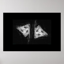 Abrupt Split Posters