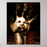 Abscess Posters