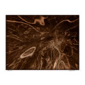 Abstract #11 posters by ascript Abstract #11 posters