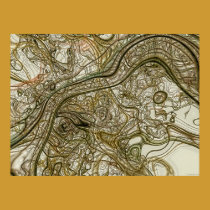 Abstract #145 posters