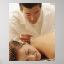 Acupuncturist putting needles in woman's back posters