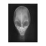 Alien X-ray Postcards