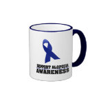 Alopecia Awareness Coffee Mug Alopecia Awareness Coffee Mug