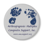 AMCSI  Arthrogryposis magnet blue