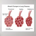 Any size lung diseases Poster posters