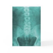 Aqua Digital X-Ray Art Greeting Card