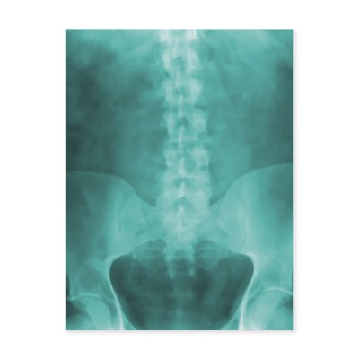 Aqua Digital X-Ray Art Postcards by chiropracticbydesign