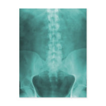 Aqua Digital X-Ray Art Postcards