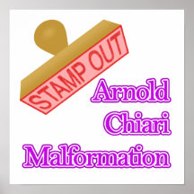 Arnold Chiari Malformation