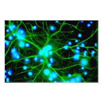 Astrocyte Are Star Shaped Glial Cells in the Brain