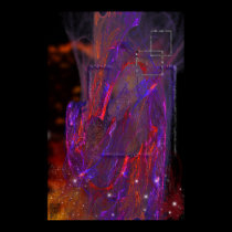 ataxia phase posters