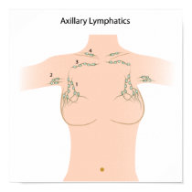 Axillary lymph nodes Poster
