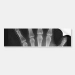 B&W X-ray Skeleton Hand Bumper Sticker