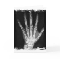B&W X-ray Skeleton Hand Greeting Cards