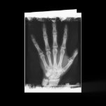 B&W X-ray Skeleton Hand Greeting Cards