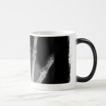 B&W X-ray Skeleton Hand Coffee Mug