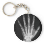 B&W X-ray Skeleton Hand Keychains