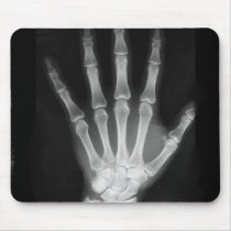 B&W X-ray Skeleton Hand Mousepad
