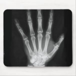 B&W X-ray Skeleton Hand mousepads