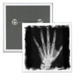 B&W X-ray Skeleton Hand Pins