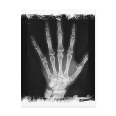 B&W X-ray Skeleton Hand Postcard by VoXeeD