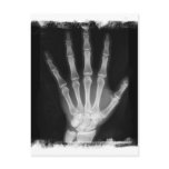 B&W X-ray Skeleton Hand Postcard