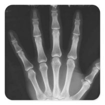 B&W X-ray Skeleton Hand Square Stickers