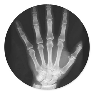 B&W X-ray Skeleton Hand Round Stickers by VoXeeD