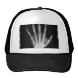 B&W X-ray Skeleton Hand Trucker Hats