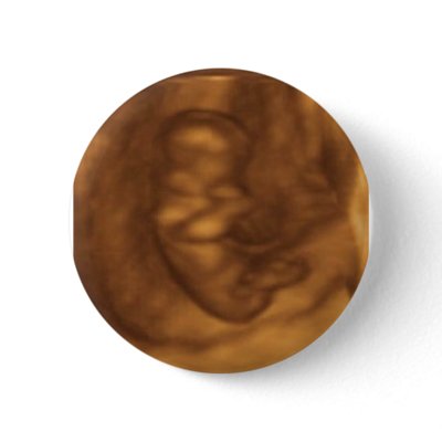 baby 3d 11 weeks buttons by luxlipps