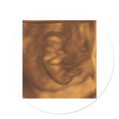 baby 3d 11 weeks stickers by luxlipps
