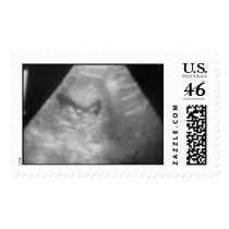 Baby Sonogram postage