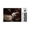 Baby Ultrasound postage