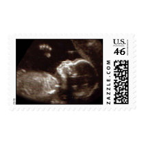 Baby Ultrasound postage by missphnx2 Baby Ultrasound postage