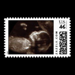 Baby Ultrasound