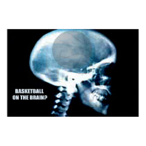 Basketball Head (X-ray) posters by draemknot Basketball Head (X-ray) posters