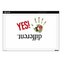 Be Different Skin For Laptop