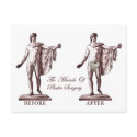 Before and After postcards