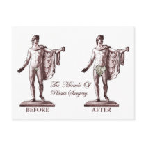 Before and After postcards