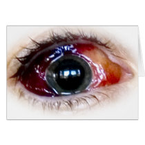 Blood shot cards