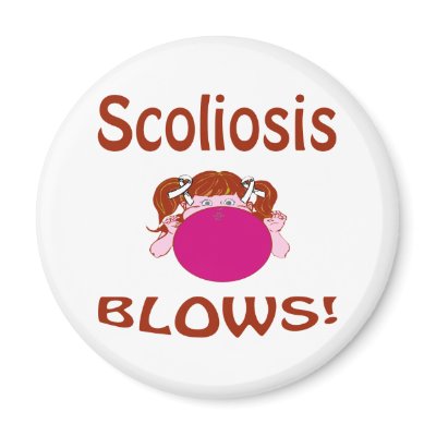 escoliosis