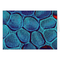 Blue blob cluster card