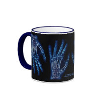 Blue Hand X-rays mug