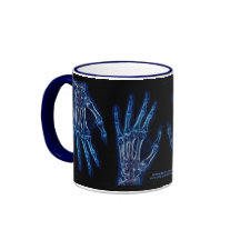 Blue Hand X-rays mug