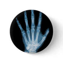 Blue X-ray Skeleton Hand Pinback Button