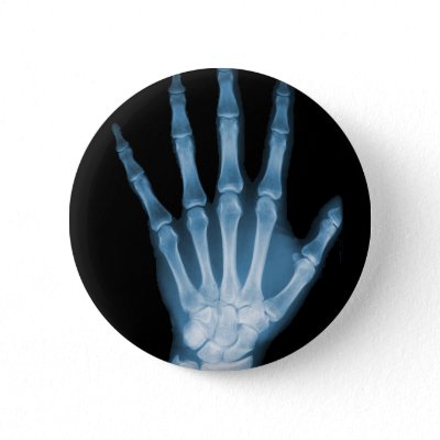 Blue X-ray Skeleton Hand Pinback Button